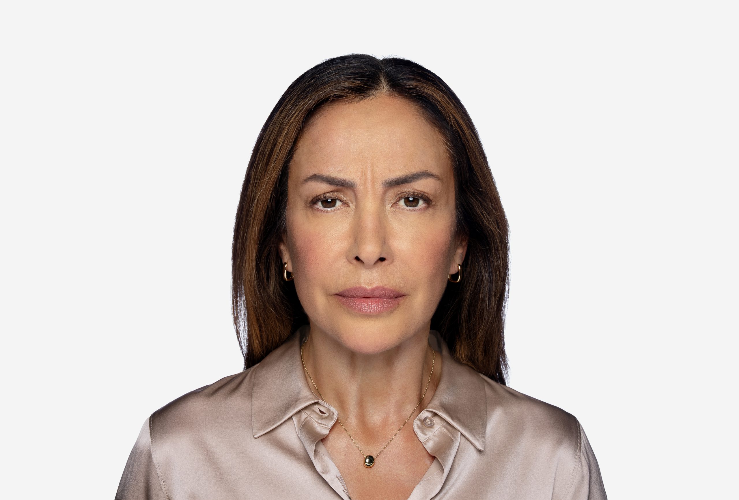 DAXXIFY patient before treatment at maximum frown