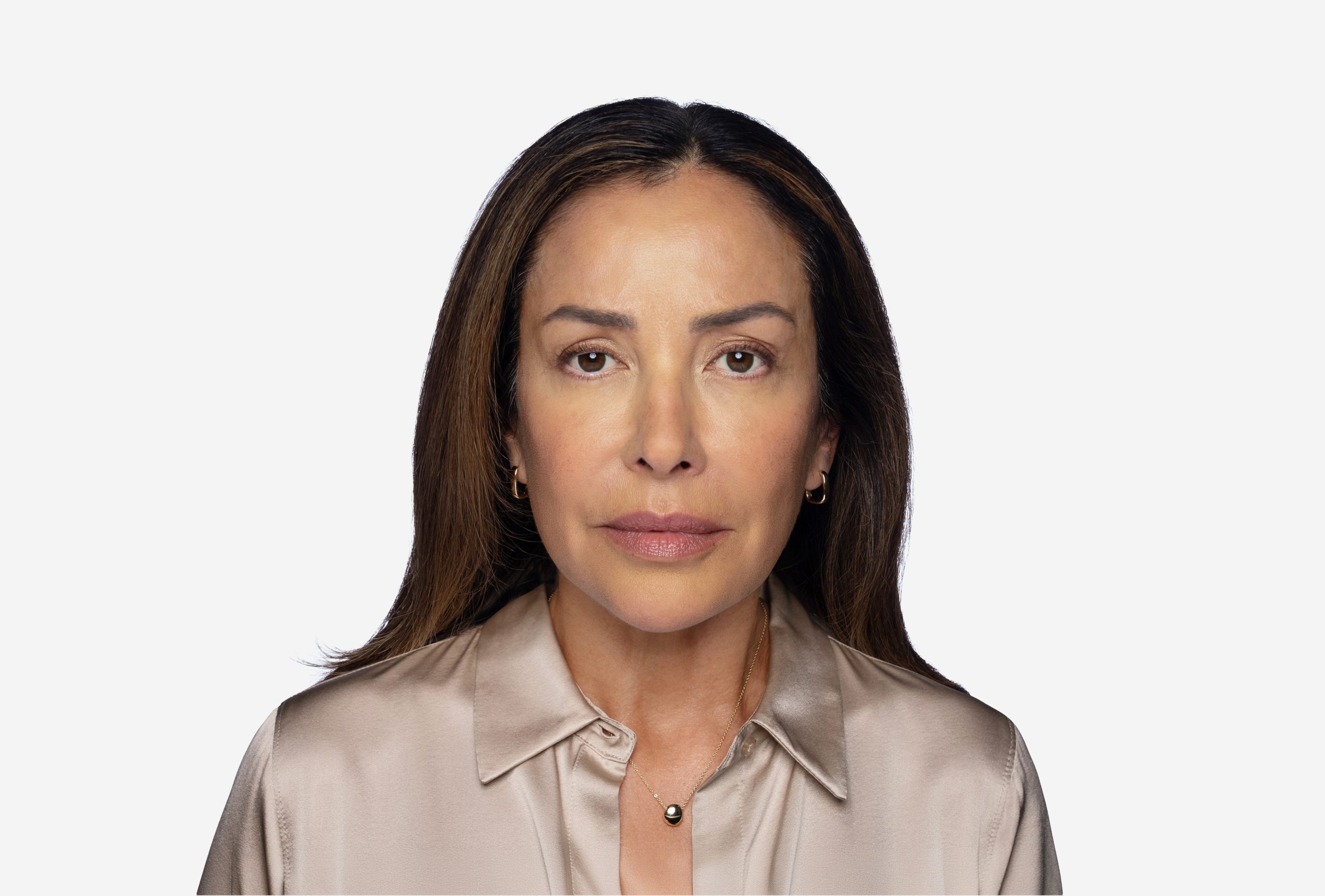DAXXIFY patient two days after treatment at maximum frown