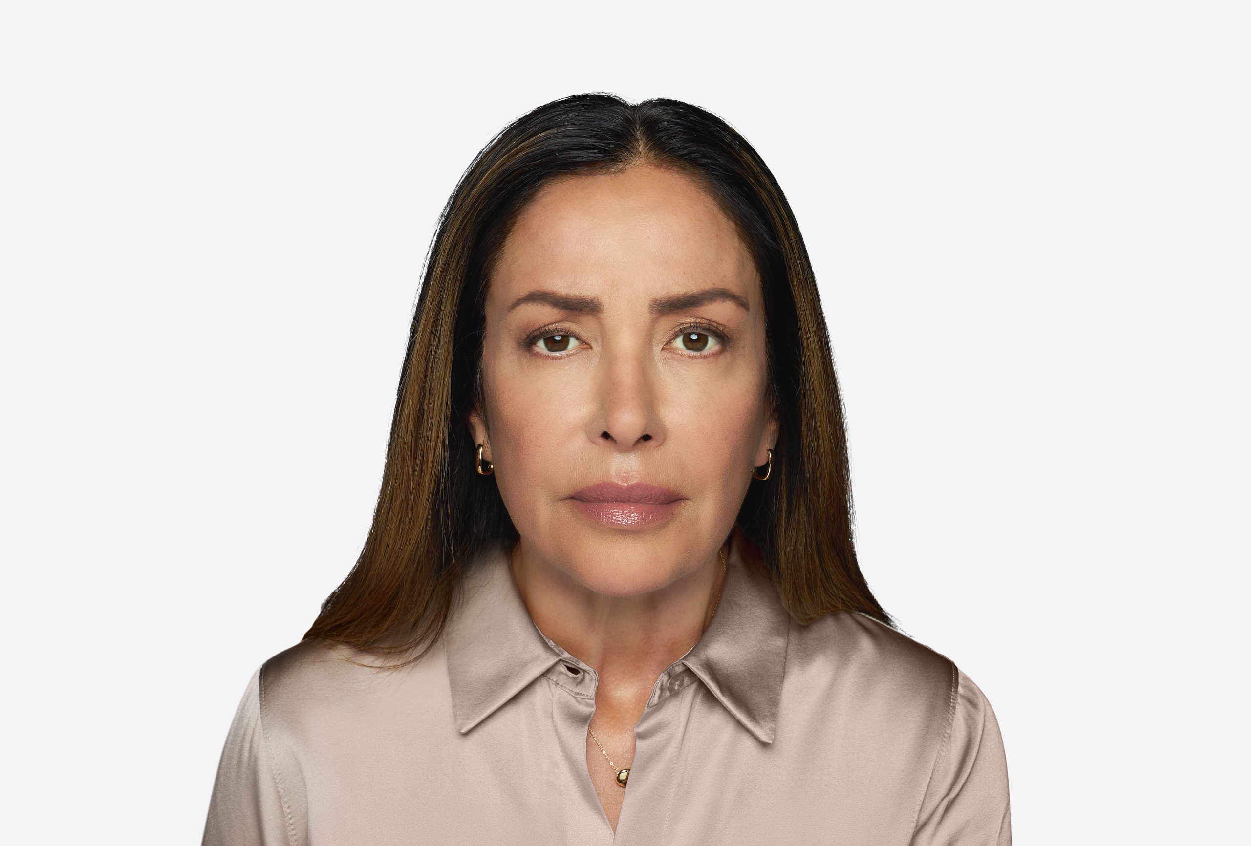DAXXIFY patient six months after treatment at maximum frown
